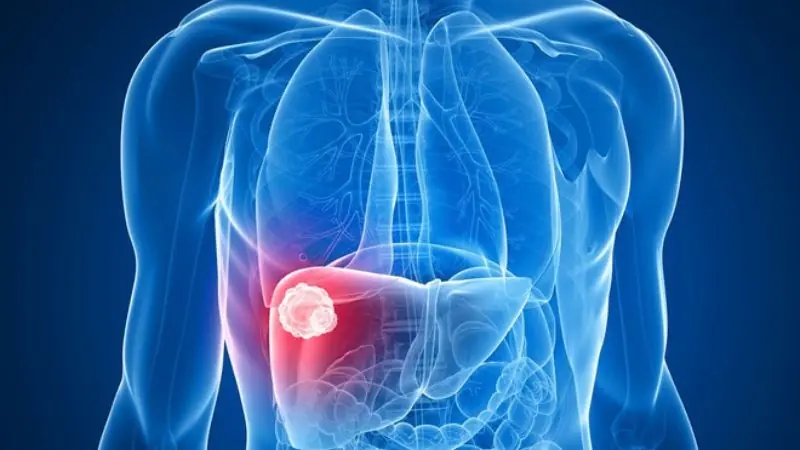 10 pancreatic can.cer symptoms you should never ignore