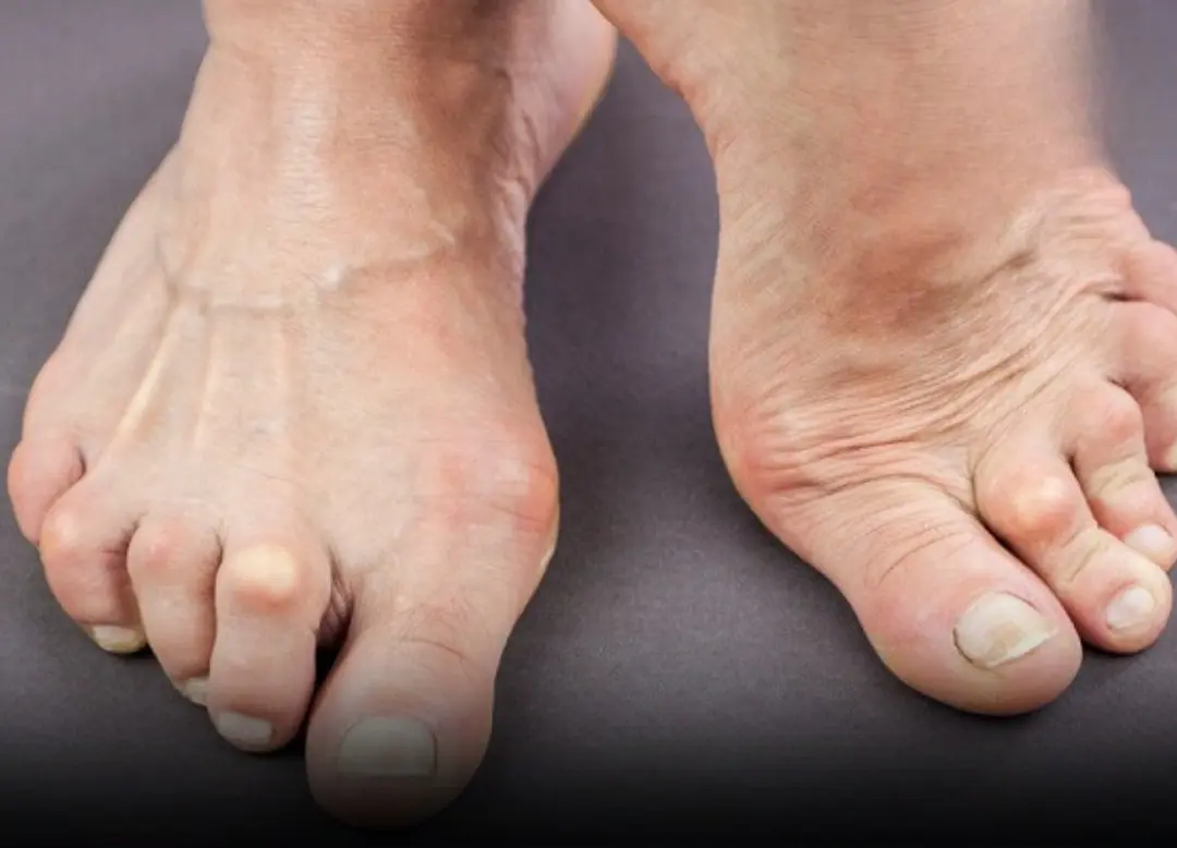 3 Foot Warning Signs That Could Indicate Serious Internal Organ Issues