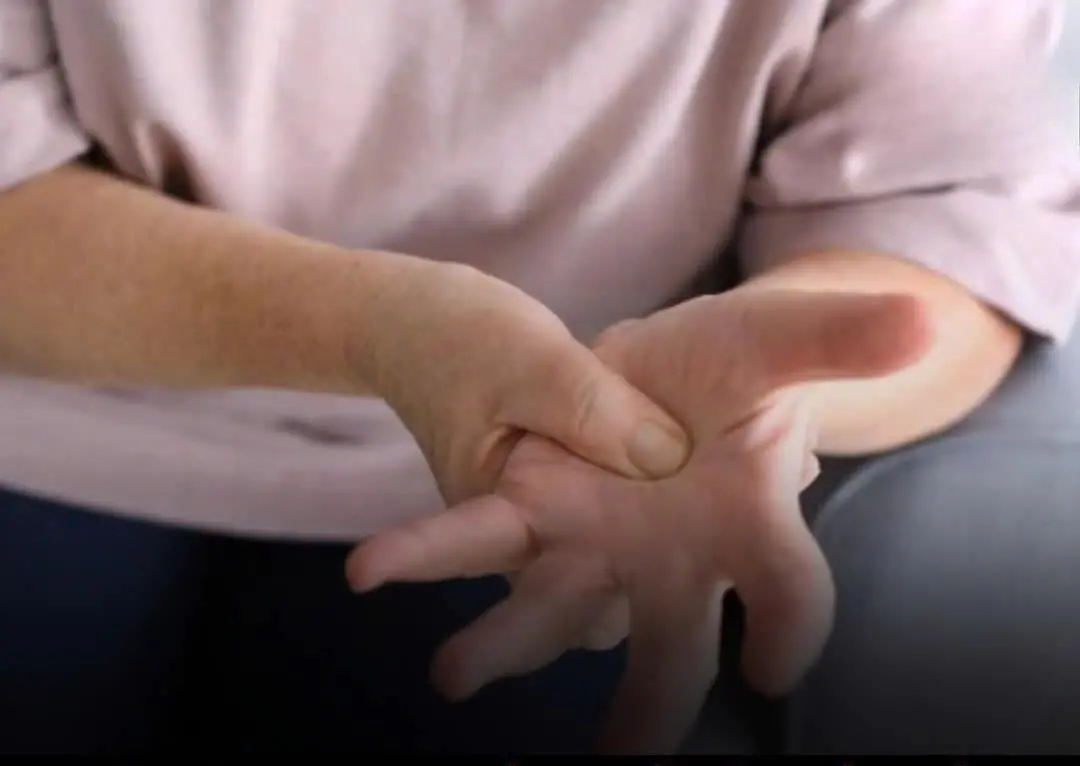 Your hands can reveal li.ver trouble — don’t ignore these shocking signs