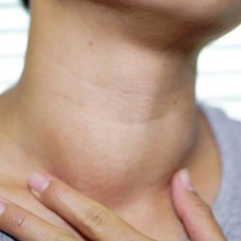 7 Subtle Body Changes That Could Signal Early Thyroid Can.cer