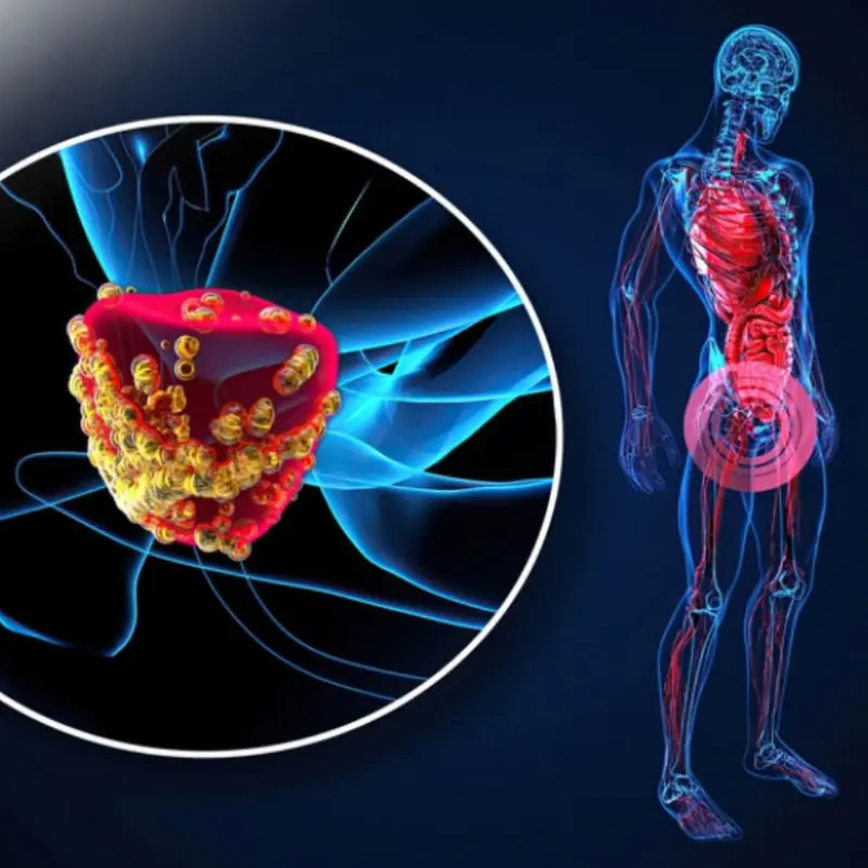 5 Warning Signs of Bladder Can.cer You Shouldn’t Overlook