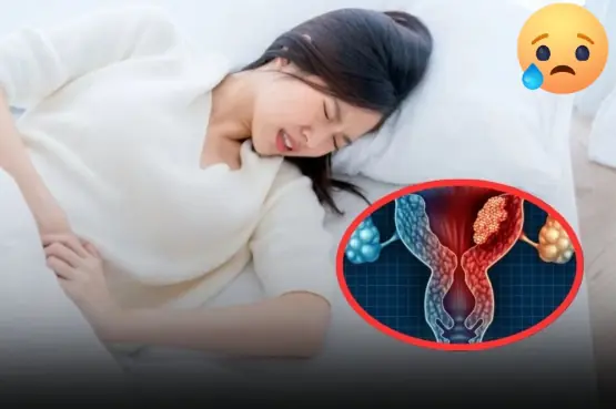 3 Intimate Habits of Husbands That May Increase Wives’ Risk of Cervical Can.cer