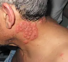 Why many experts advise against sleeping with window open