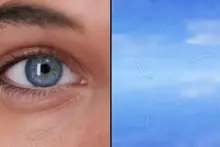 Eye doctor explains what to do if you start seeing 'floaters'