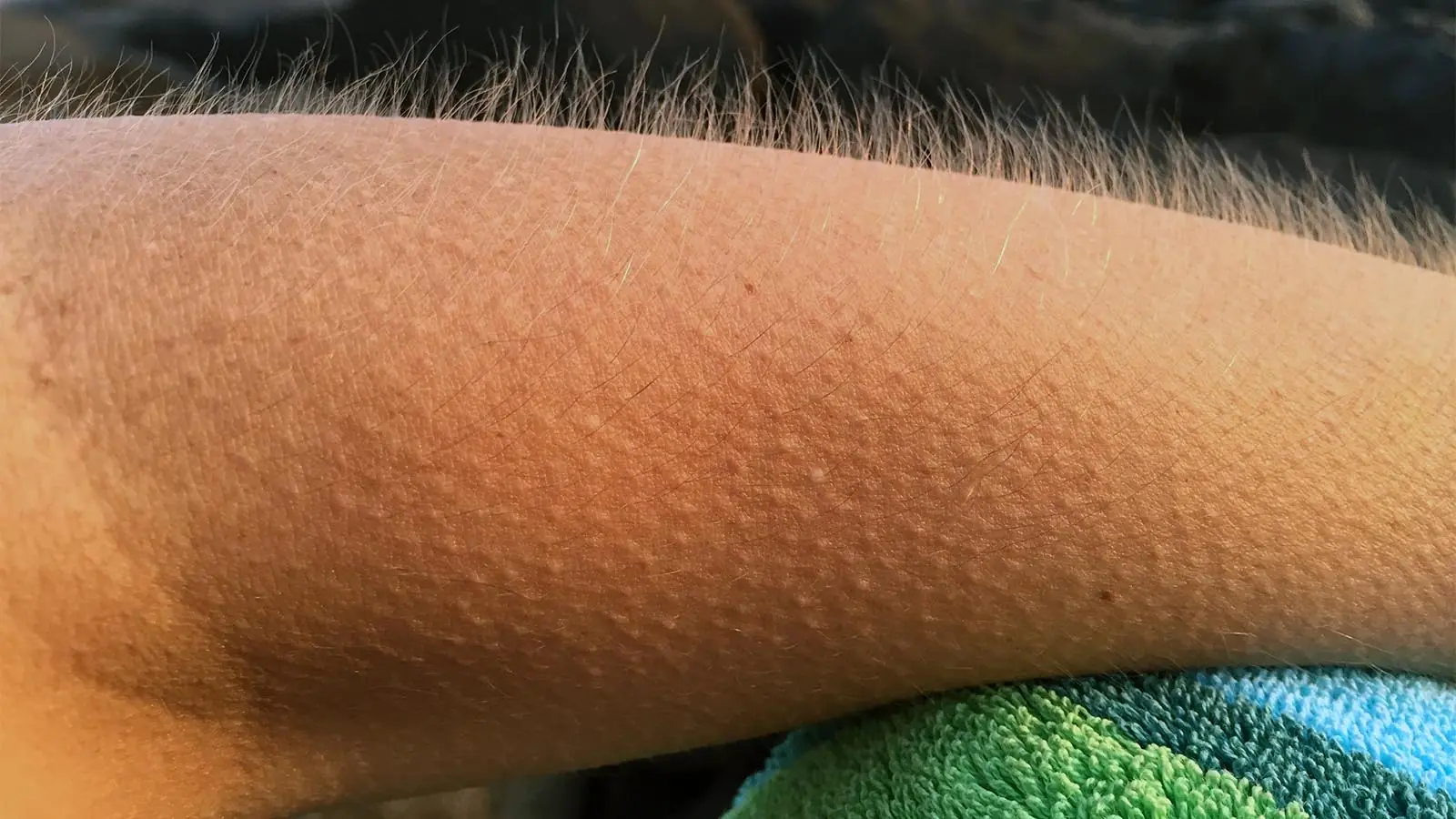 Why You Suddenly Get Goosebumps—Even When Nothing Happens