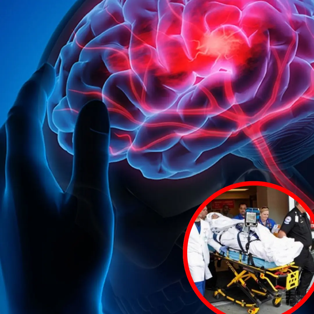 Stroke Prevention Tips: 3 Things to Avoid After Eating and 4 Before Bedtime