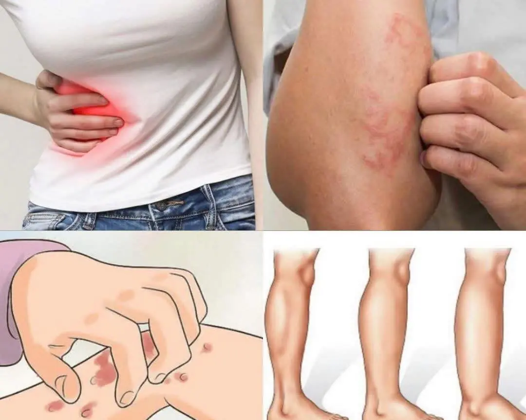 🩺 If Your Kidneys Are in Danger, Your Body Will Warn You With These 8 Signs: