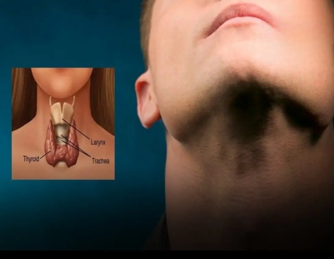 Your Thyroid Is Begging You to Stop Eating These 6 Foods Immediately!