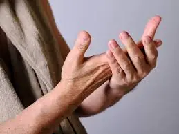 3 Warning Signs on Your Hands That Could Indicate Liver Failure