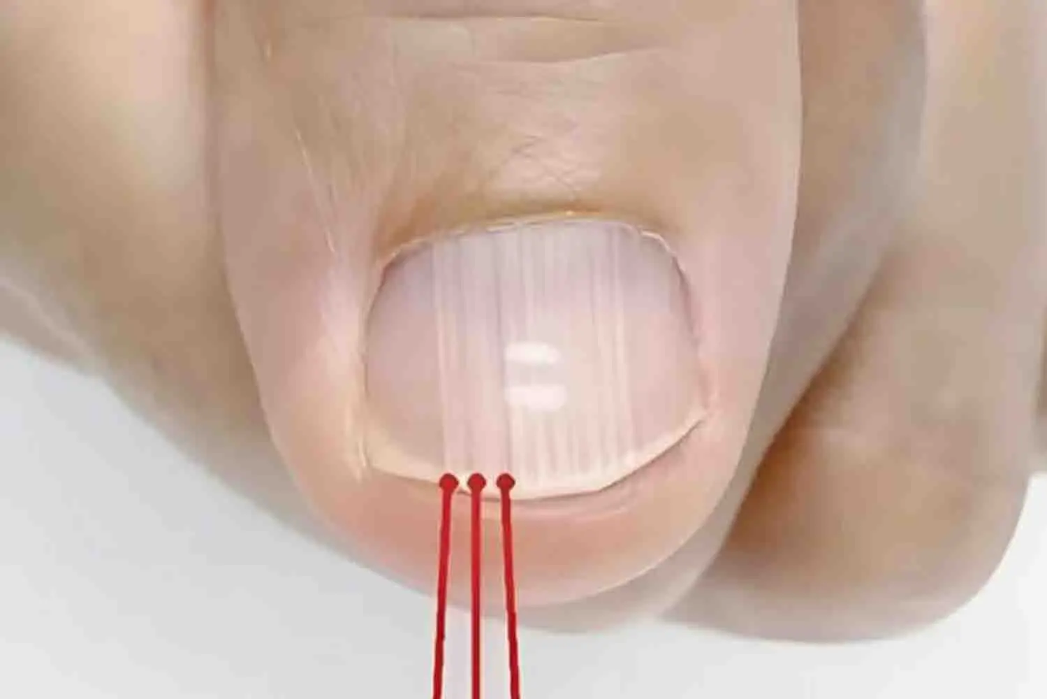 If You Have These Lines on Your Nails After 40, Here’s What They Could Mean