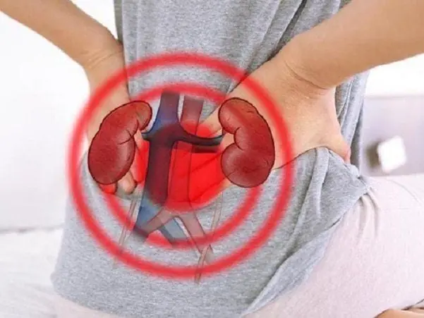 These 4 Types of Water Can Help Stop Kidney Stones From Forming