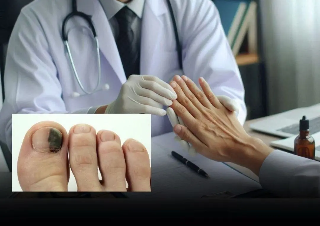 3 Early Changes in Your Arms or Legs When Ca.nc.er Develops