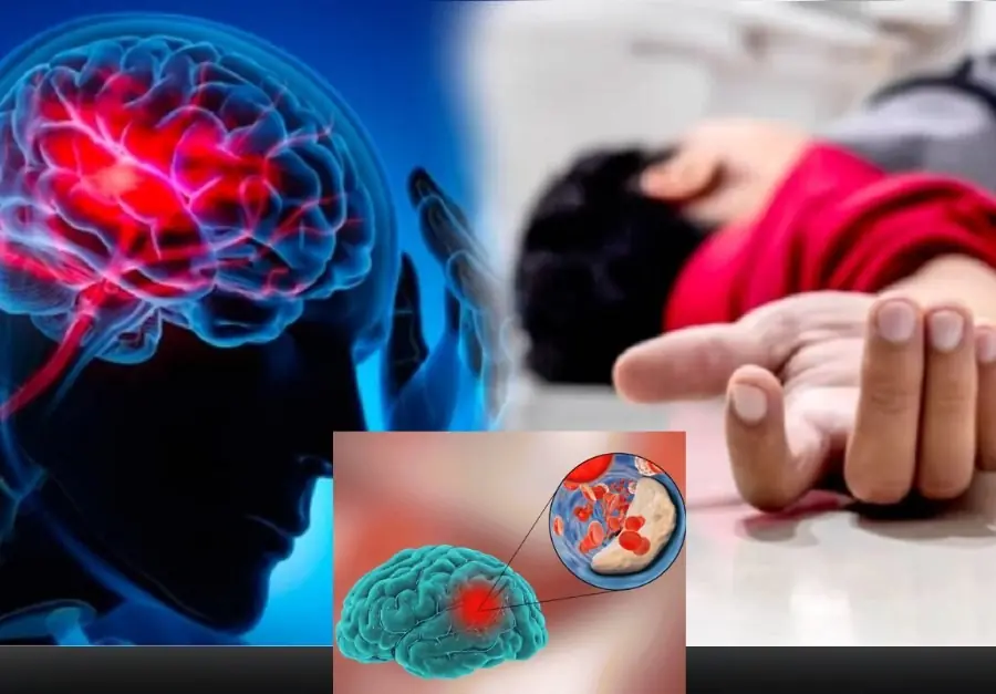 Warning: The Body May Send 5 SOS Signals Before a Stroke Occurs — Do Not Be Complacent