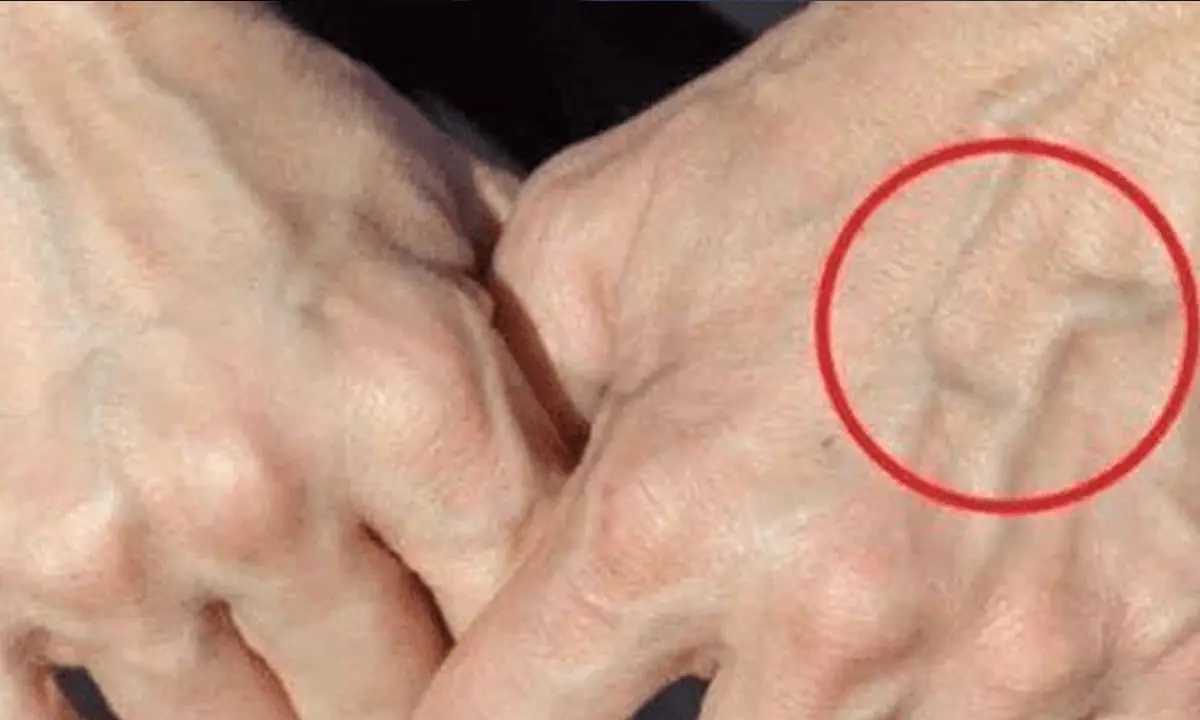 Noticing More Veins on Your Hands? Your Body Might Be Warning You of an Underlying Issue