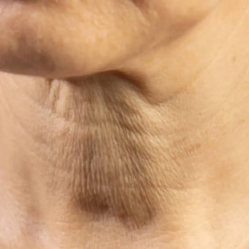 If Your Neck Looks Looser Than Before, Your Body May Be Telling You Something