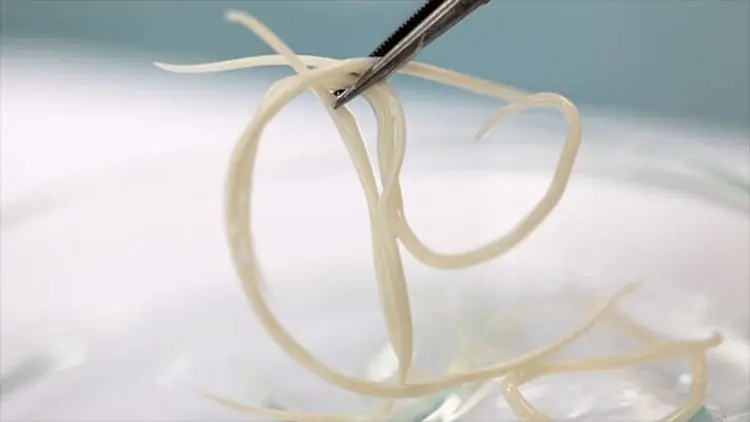 5 types of vegetables contain "a nest of hidden worms", eating them raw is equivalent to swallowing all the parasites in your stomach