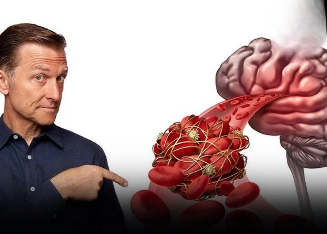 9 Silent Warning Signs of a Brain Blood Clot That Can Appear Weeks Before a Stroke