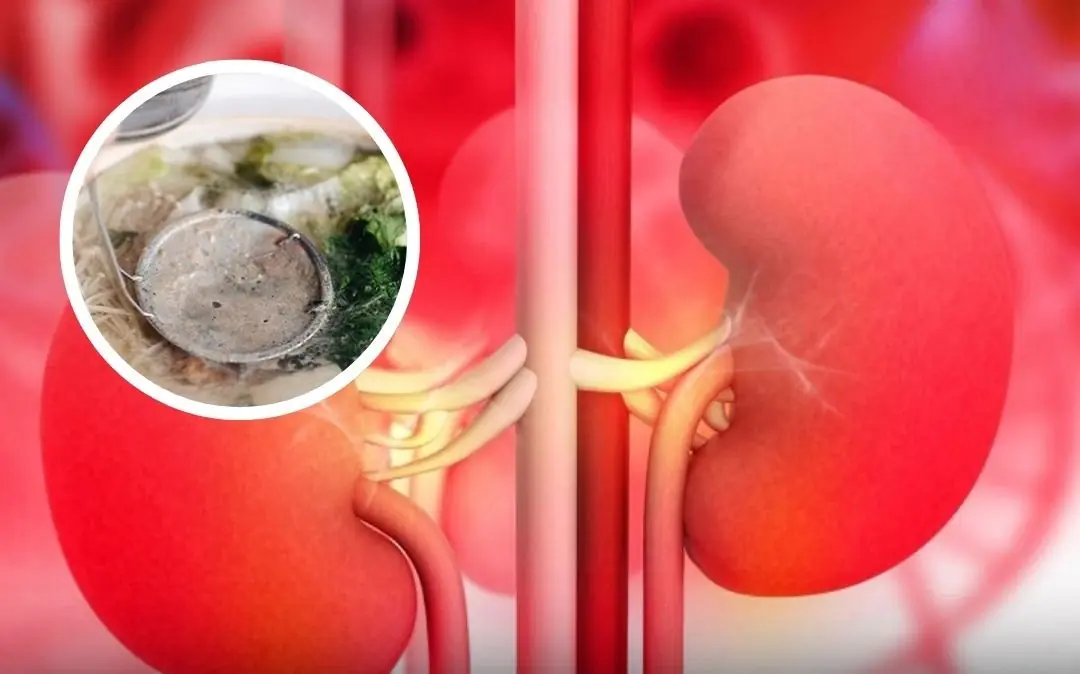 These 4 Common Dishes Could Be Har:ming Your Kidneys