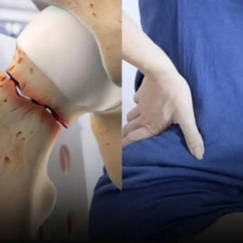 Postmenopausal Women and Osteoporosis: Who Faces Lower Risk?