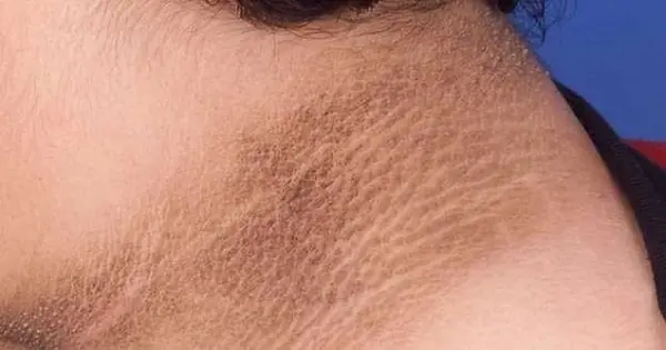 The 5 Main Warning Signs of Diabetic Neuro.pathy, According to Speci.alists