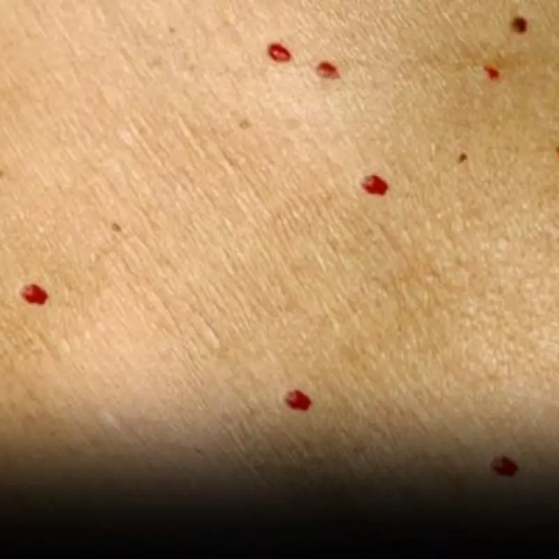 Red Dots on Your Skin: What Your Body May Be Trying to Tell You