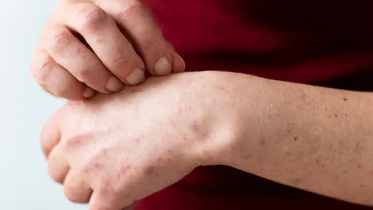 Itching in 9 areas of the body: When it could be a warning sign of serious illness