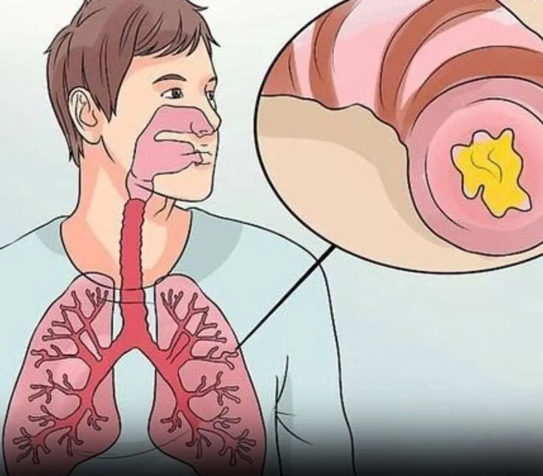 Clear your throat and lungs of mucus with this recipe – just 2 ingredients