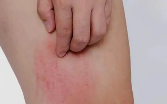 Two it.chy body parts may signal liver can.cer