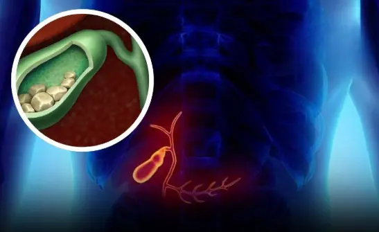 6 silent symptoms warning of gallbladder c.a.ncer