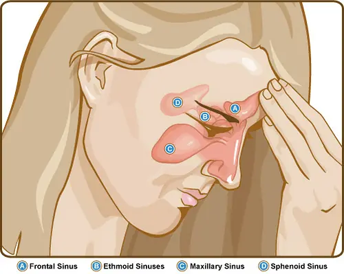 Suffering From a Sinus Infection? Try These Powerful Home Remedies
