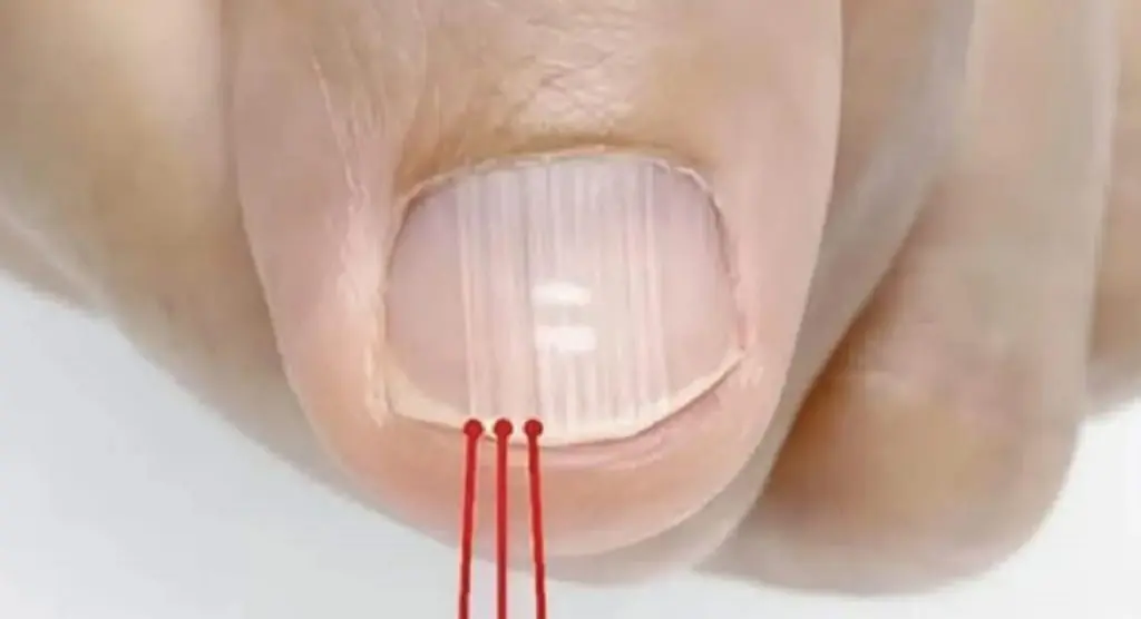 Over 40? Lines on Your Nails May Reveal More Than You Think