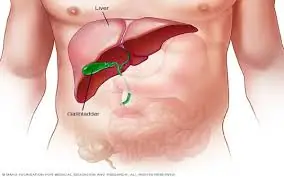 Had Your Gallbladder Removed? Here’s What Happens Next — and 3 Risks to Watch For