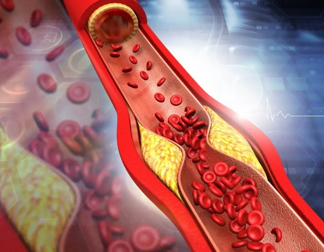 The daily drink that helps clear blocked arteries naturally.....