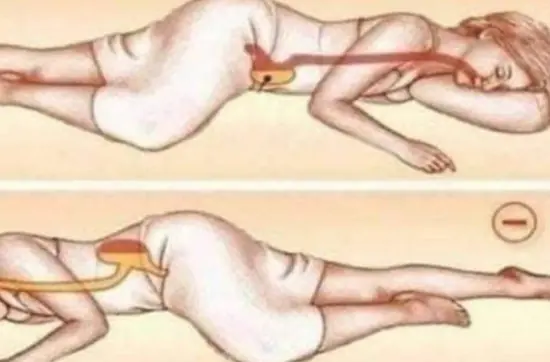 Why Sleeping on Your Left Side Is the Best Thing You’re Not Doing