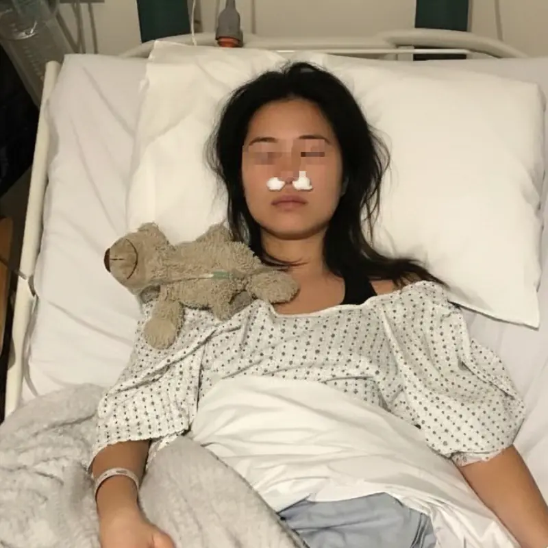 Woman Suffers Nasal Fungal Infection Linked to Everyday Habit