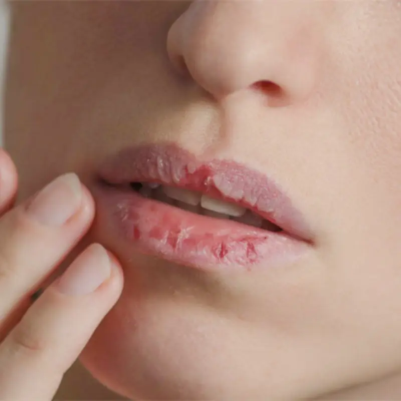 Experts Warn About 5 Can.cer Warning Signs Many People Overlook