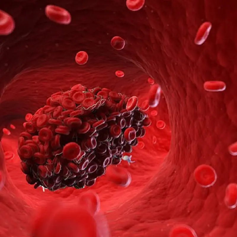 A Simple Daily Drink That May Support Cleaner, Healthier Arteries