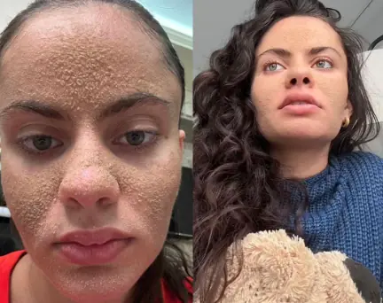 22-year-old tiktoker goes viral for not washing her face for 7 weeks in a new ‘skincare routine’