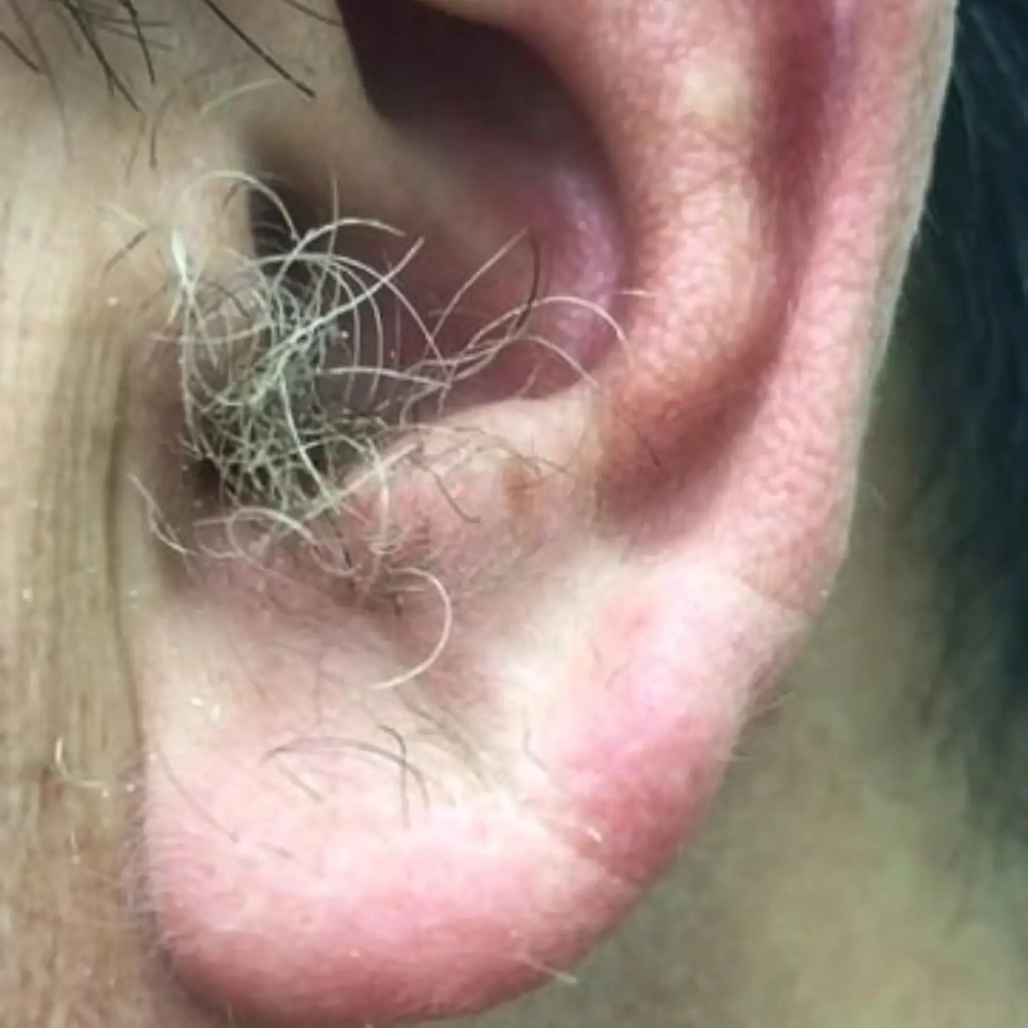 Ear Hair and Your Health: What Doctors Say About This Overlooked Body Sign