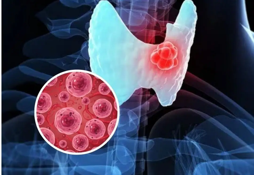 No matter how delicious it is, you can't eat it again.