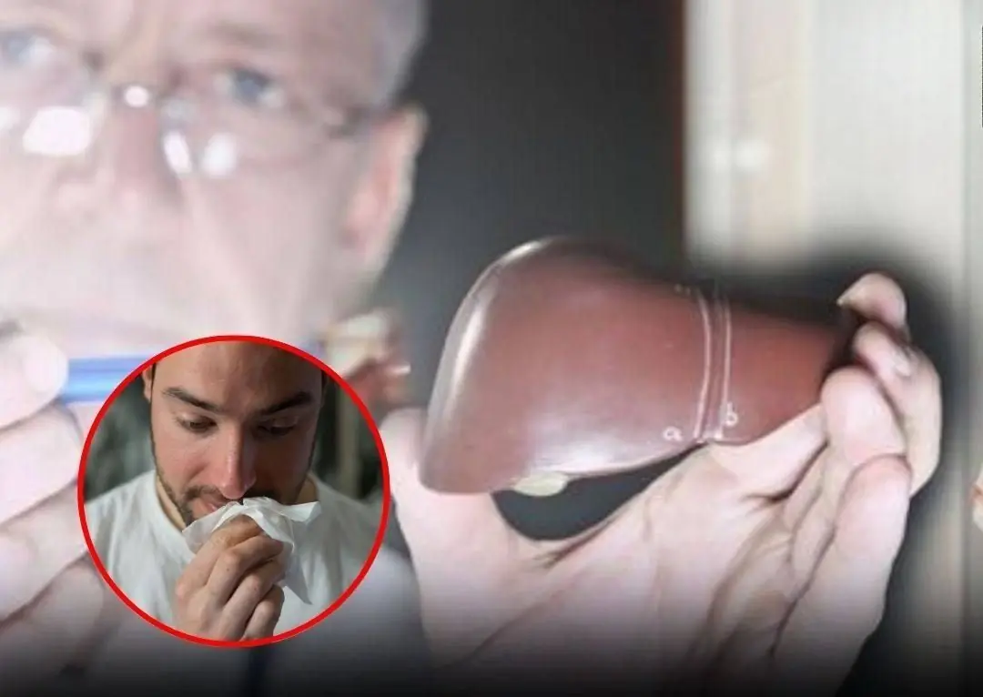 Your nose could be warning you: 5 signs linked to liver disease and ca.n.cer — take them seriously!