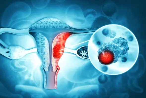 3 Intimate Habits of Husbands That May Increase Wives’ Risk of Cervical Can.cer