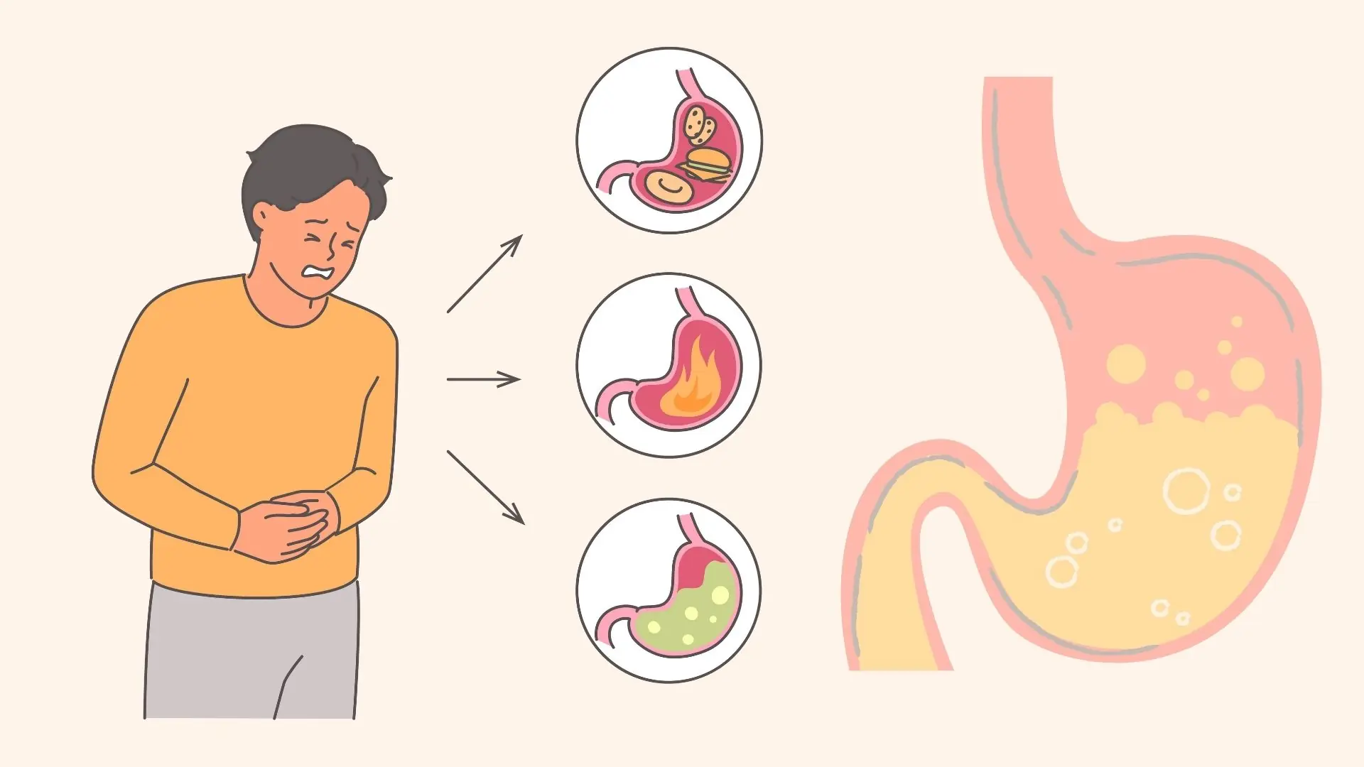 8 Warning Signs That Your Stomach Condition May Be Getting Serious — Don’t Ignore These Symptoms