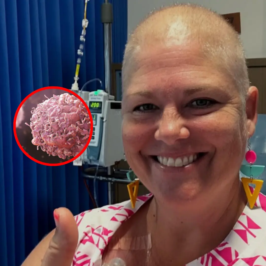 Stage 4 cancer patient warns overlooked minor signs can mask a fatal disease