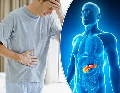 Signs of pancreatic cancer you should never ignore