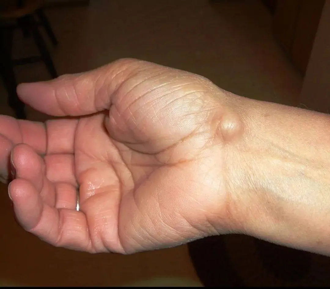 Attention! This Lump may appear due to something you do everyday