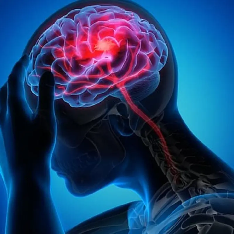9 Subtle Warning Signs of Brain Clots Weeks Before a Str.oke