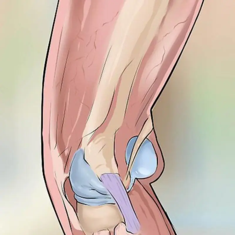 Pa.in Behind the Knee: A Serious Warning Sign You Shouldn’t Ignore