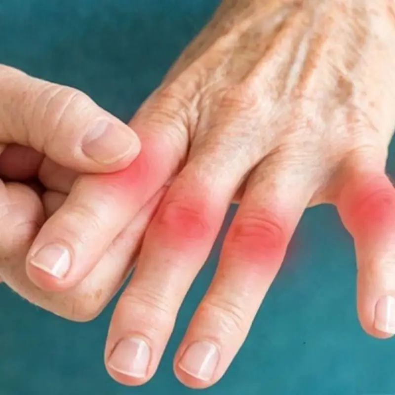 A Common Illness May Be Growing Inside You — and One Habit Fuels It