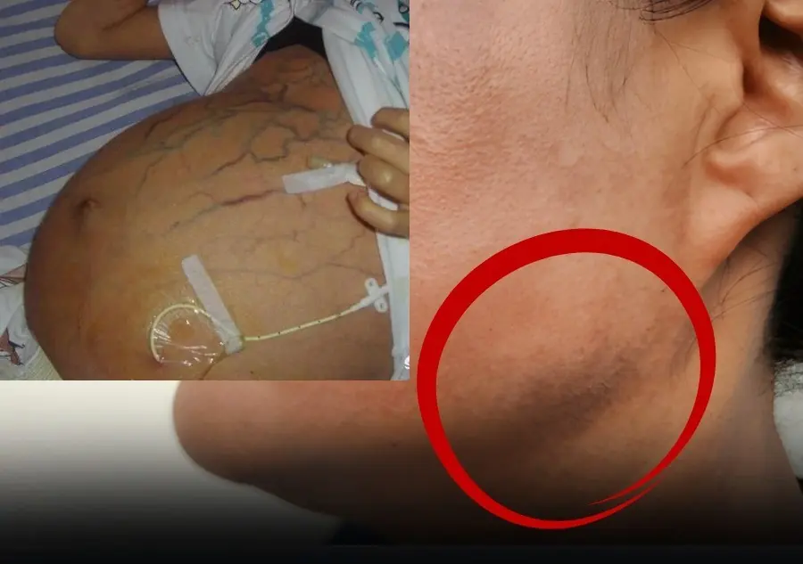 Can:cer may show up as DARK patches… Do you have any of these 7 signs?